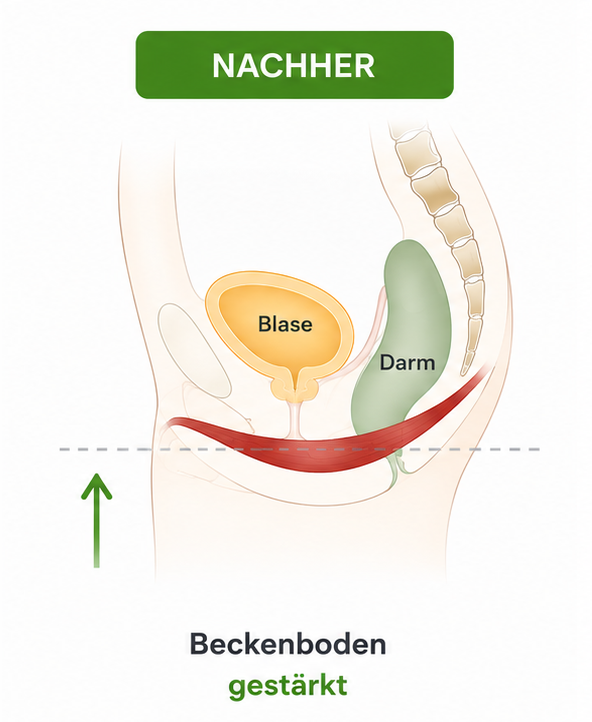 Blasenschwäche Frau Bonn